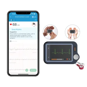 Touchscreen ECG Monitor