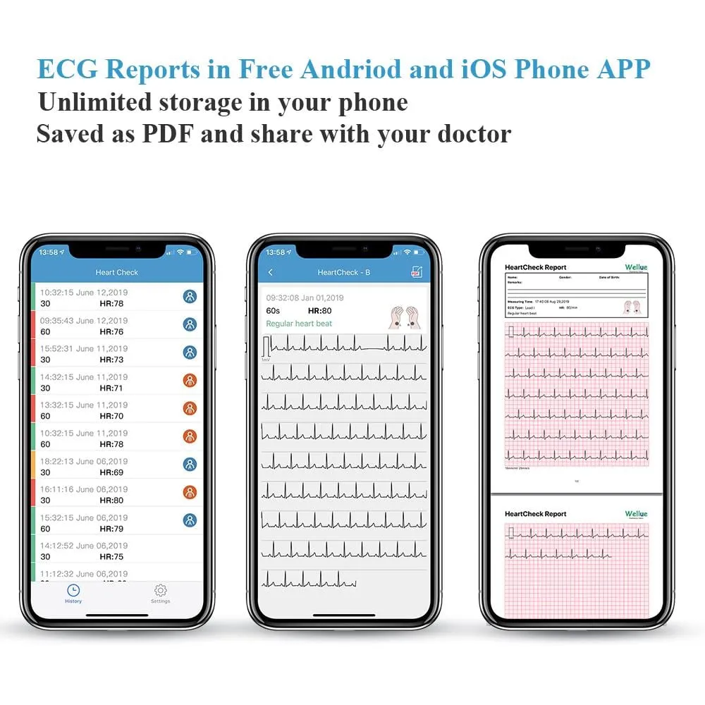 Touchscreen ECG Monitor