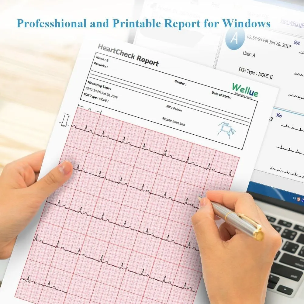 Touchscreen ECG Monitor